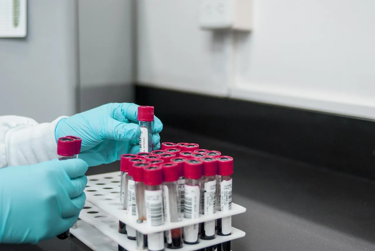 Gloved hands sorting red-capped sample tubes in a rack on a lab bench
